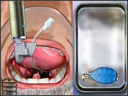 Krok 2 - Intubacja | Podstawy House M.D. - House M.D. - poradnik do gry