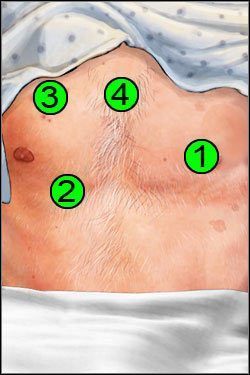 Symptomy: Klatka piersiowa - Opis przejścia (1) | Globetrotting House M.D. - House M.D. - poradnik do gry