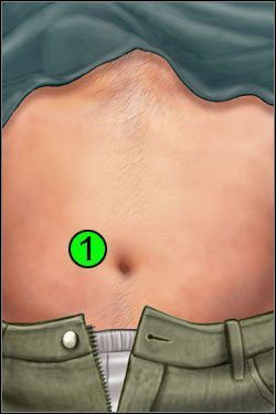 Symptomy: Brzuch - Opis przejścia (2) | Blue Meanie | House M.D. - House M.D. - poradnik do gry