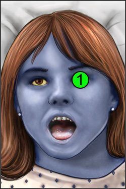 Symptomy: Głowa - Opis przejścia (3) | Blue Meanie | House M.D. - House M.D. - poradnik do gry