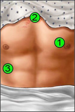 Symptomy: Klatka piersiowa - Opis przejścia (1) | Skull & Bones | House M.D. - House M.D. - poradnik do gry