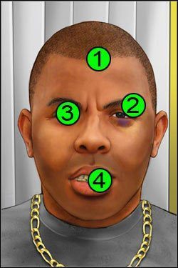 Symptomy: Głowa - Opis przejścia (2) | Skull & Bones | House M.D. - House M.D. - poradnik do gry