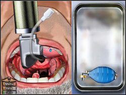 Wykonaj na pacjencie intubację - Opis przejścia (3) | Skull & Bones | House M.D. - House M.D. - poradnik do gry