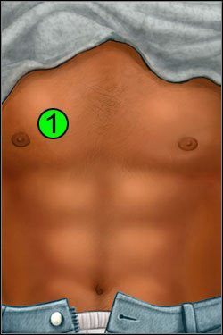 Symptomy: Klatka piersiowa - Opis przejścia (4) | Skull & Bones | House M.D. - House M.D. - poradnik do gry