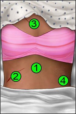 Symptomy: Klatka piersiowa - Opis przejścia (1) | Crashed | House M.D. - House M.D. - poradnik do gry