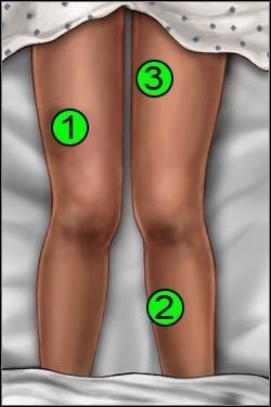 Symptomy: Nogi - Opis przejścia (1) | Crashed | House M.D. - House M.D. - poradnik do gry