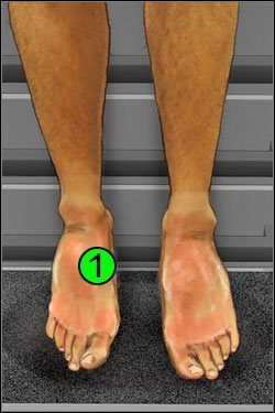 Symptomy: Nogi - Opis przejścia (3) | Crashed | House M.D. - House M.D. - poradnik do gry