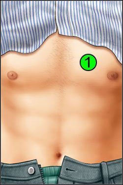 Symptomy: Klatka piersiowa - Opis przejścia (1) | Under The Big Top | House M.D. - House M.D. - poradnik do gry