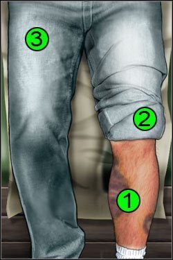 Symptomy: Nogi - Opis przejścia (1) | Under The Big Top | House M.D. - House M.D. - poradnik do gry