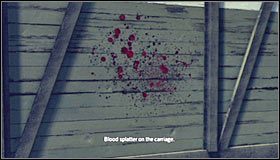 Zbadanie lewej ręki możesz pominąć, gdyż nie wiążą się z tym żadne sensacyjne odkrycia - Case 12 - The Studio Secretary Murder (1) | Główne śledztwa w LA Noire - L.A. Noire - poradnik do gry