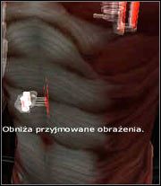 3 - Poradnik do gry - Implanty | Chrome - Chrome - poradnik do gry