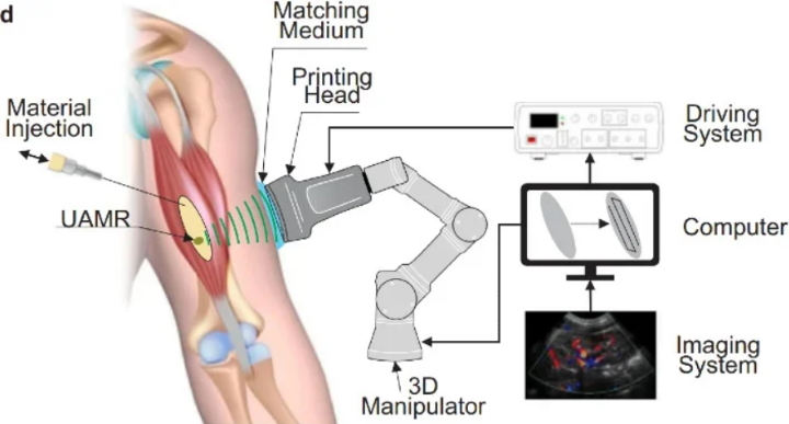 Nowa metoda pozwoli drukować w 3D wewnątrz ciała - ilustracja #1